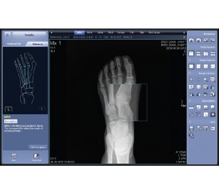 Rayence XmaruView Podiatry Imaging Software