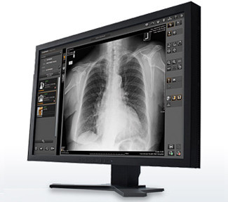 Carestream Image Suite / V4 Software